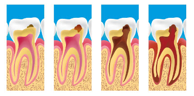 dentiste Voisins-le-Bretonneux