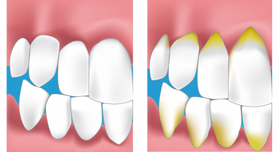 dentiste voisin le bretonneux